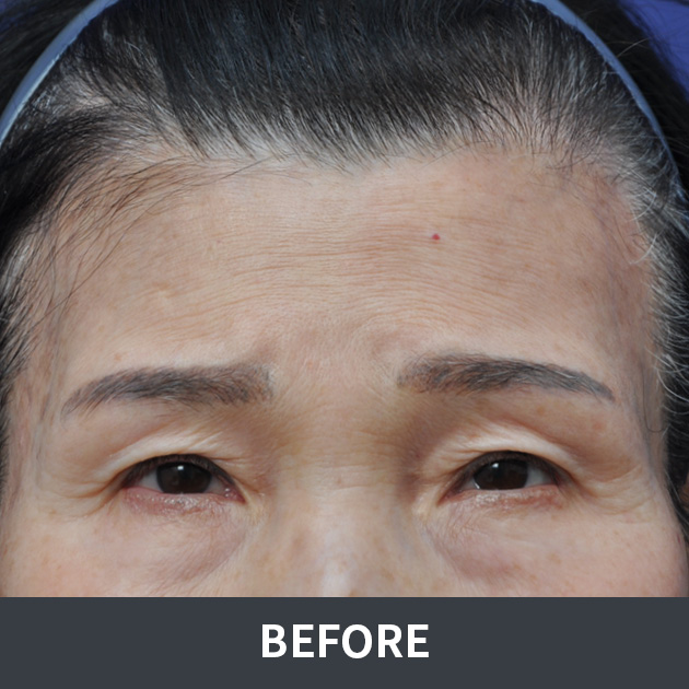 afterPhoto